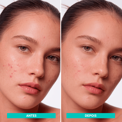 ANTES-DEPOIS
